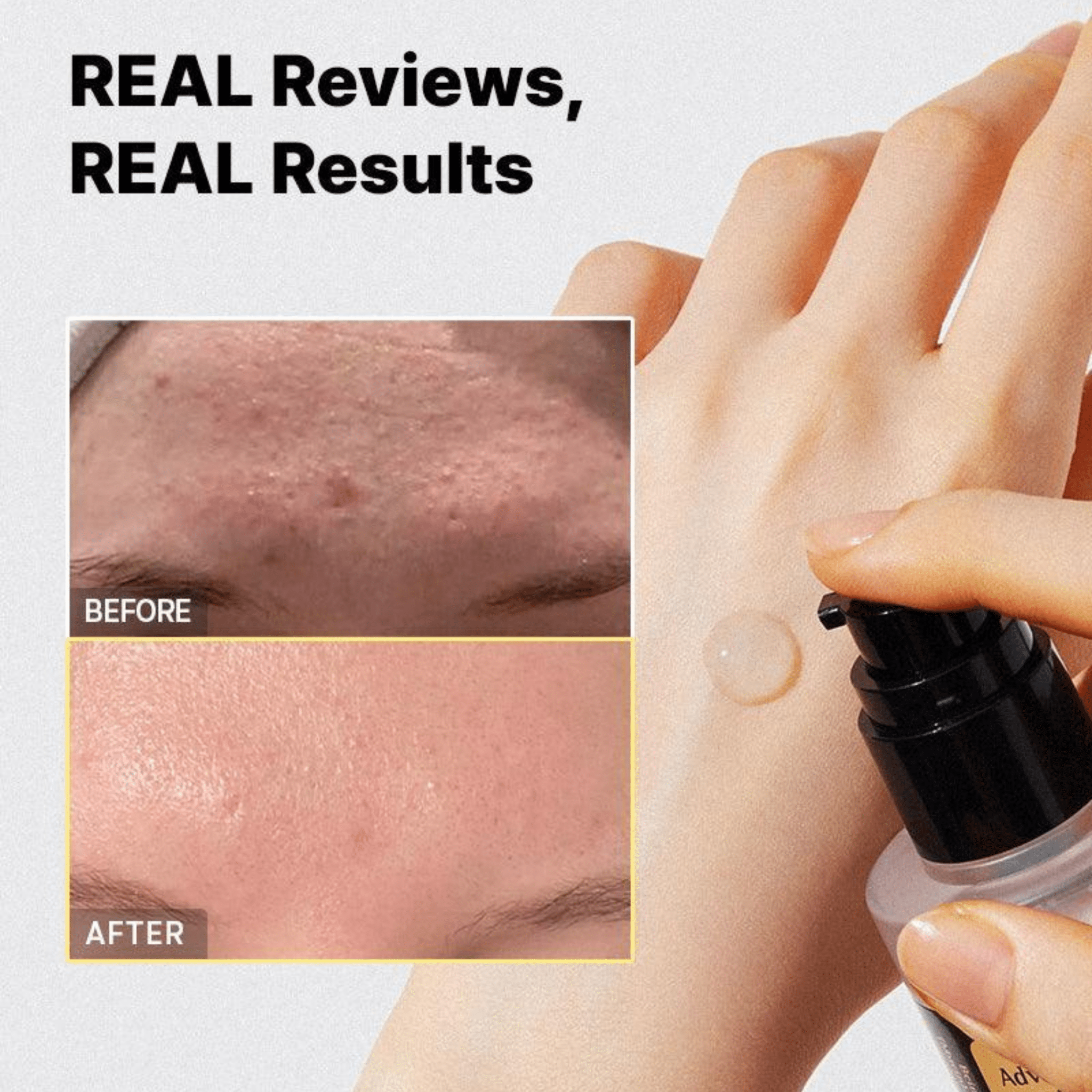 COSRX Advanced Snail 96 Mucin Power Essence - Routisca