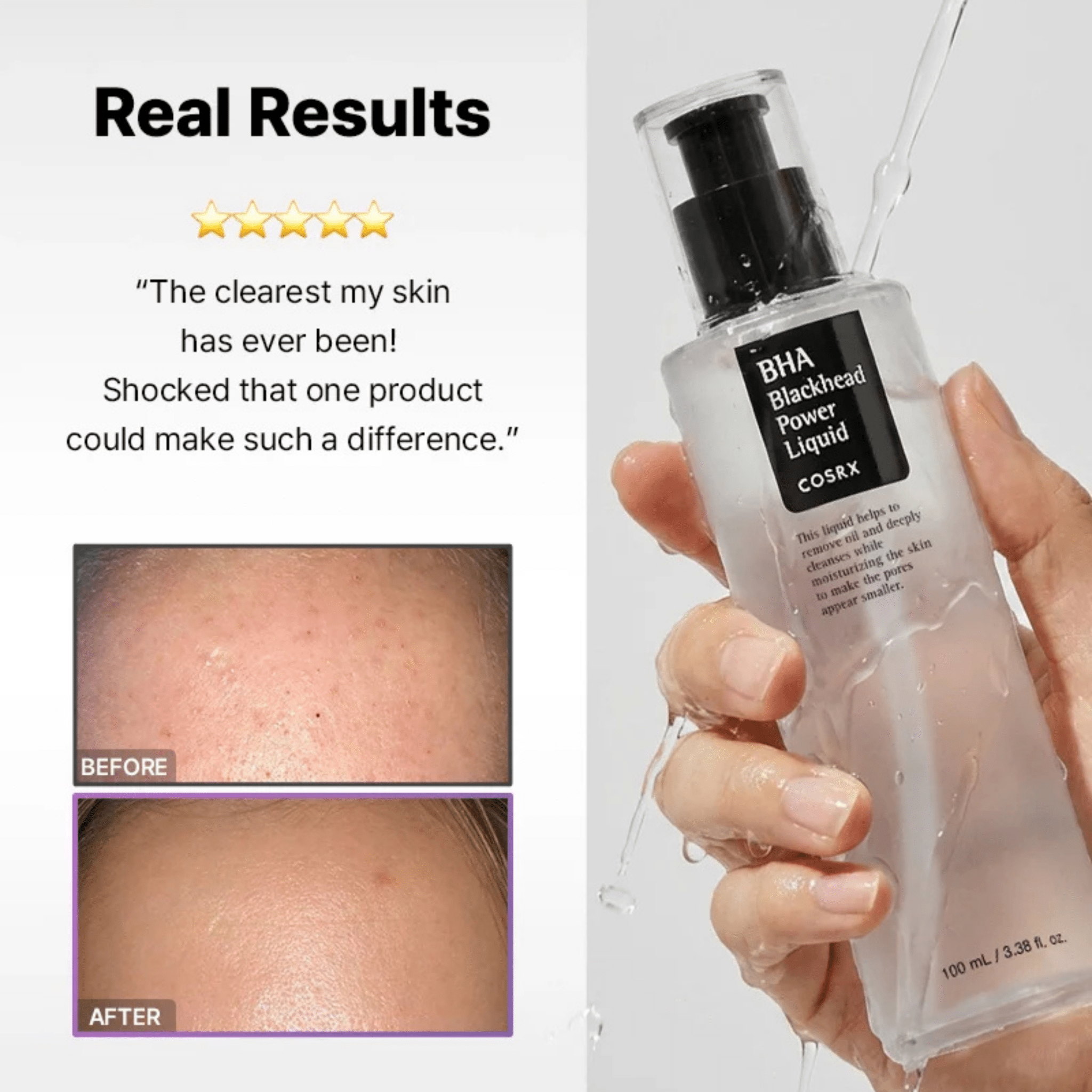 COSRX BHA Blackhead Power Liquid - Routisca