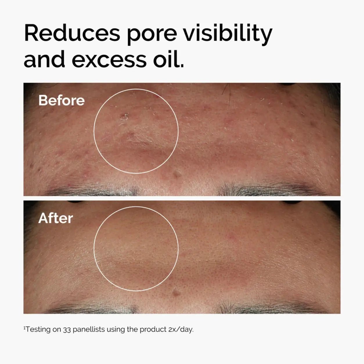 The Ordinary Niacinamide 10% + Zinc 1% - Routisca