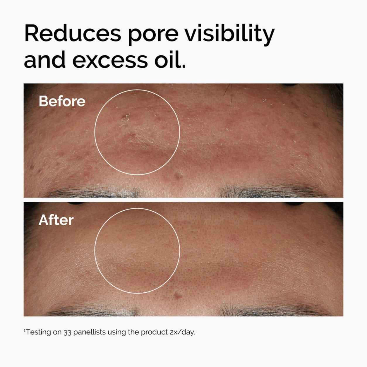 The Ordinary Niacinamide 10% + Zinc 1% - Routisca
